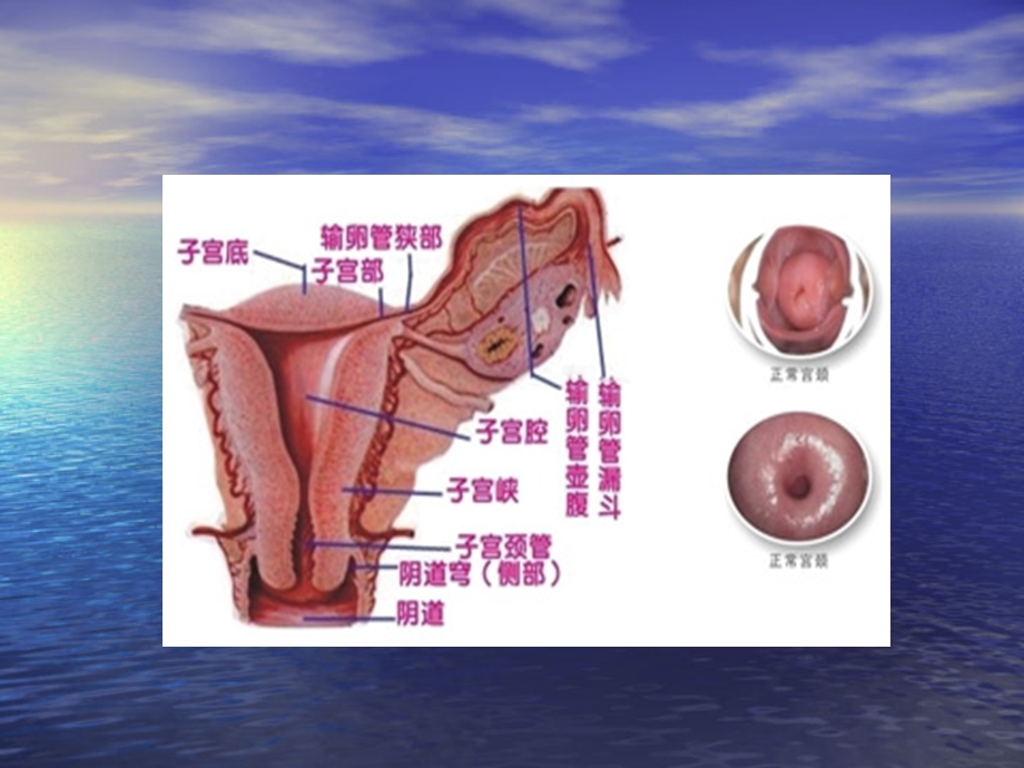 宫颈疾病的预防与诊治课件.pptx_第3页