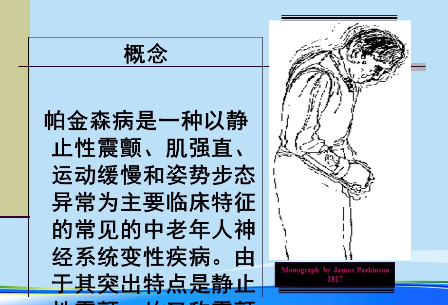 帕金森病护理常规.完整版PPT资料课件.ppt_第2页