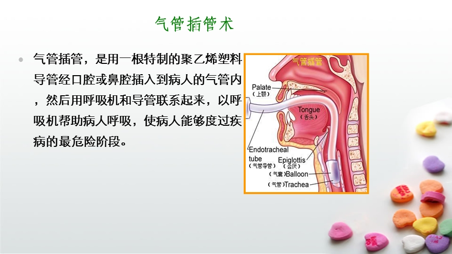 气管插管术课件教学.pptx_第3页