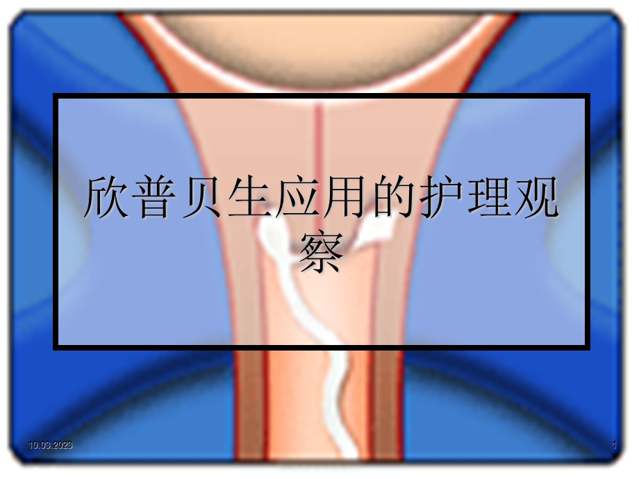 欣普贝生应用的护理观察课件.ppt_第1页