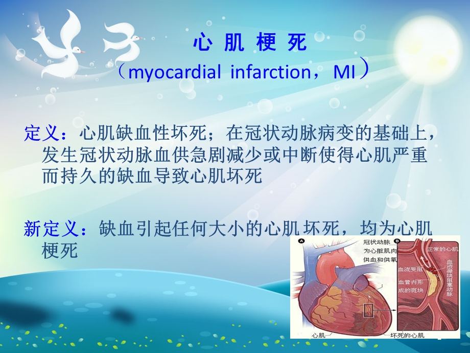 急性心肌梗死 ppt课件.ppt_第1页