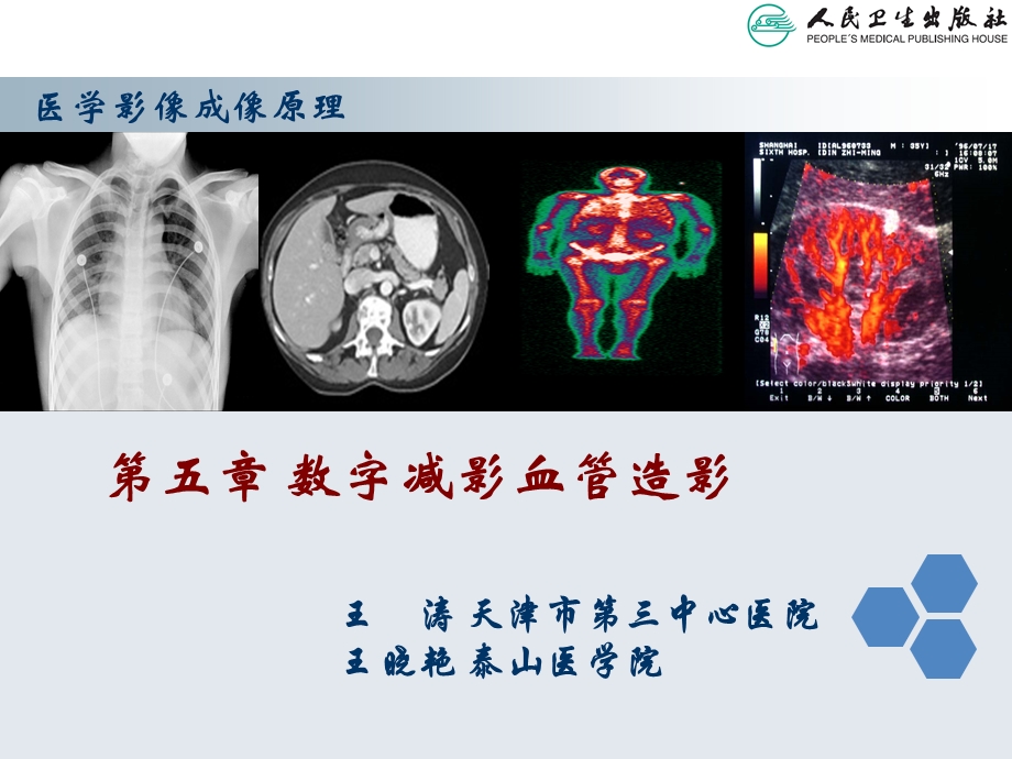 数字减影血管成像课件.ppt_第2页