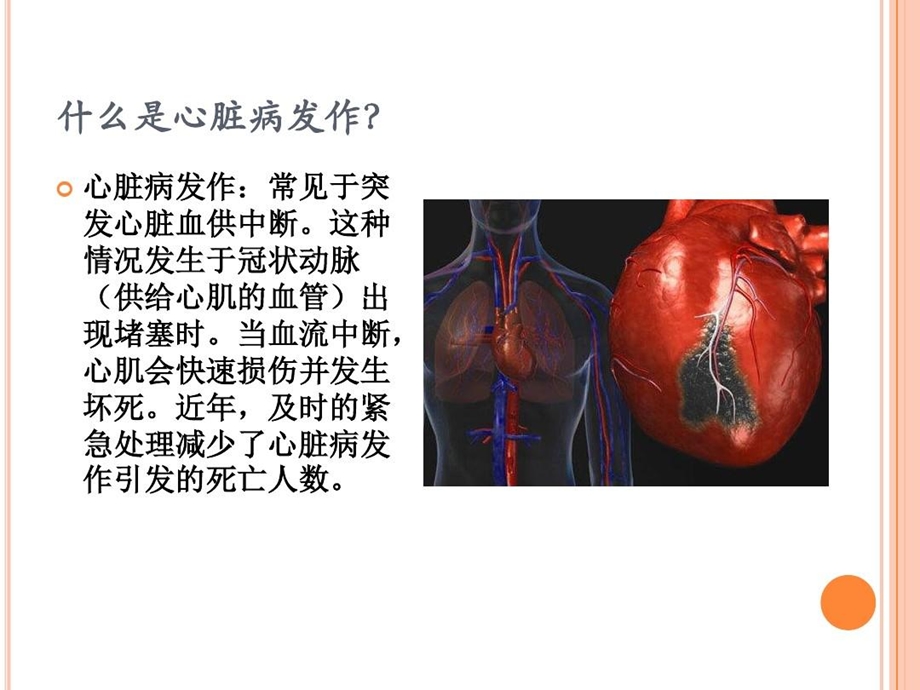 心脏病及超声心动图科普课件.ppt_第3页