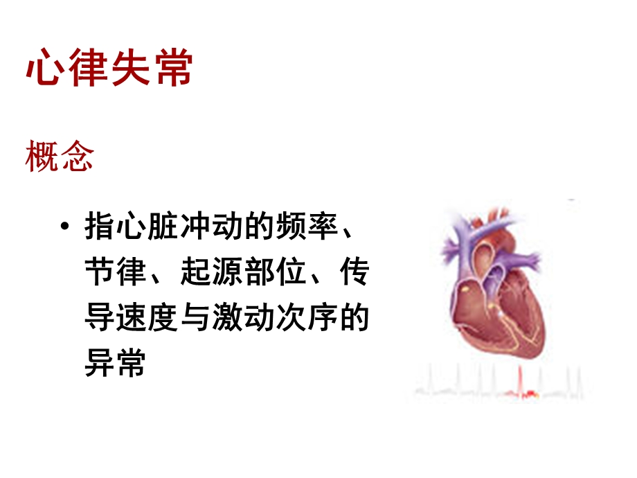 心律失常病人的护理培训ppt课件.ppt_第2页