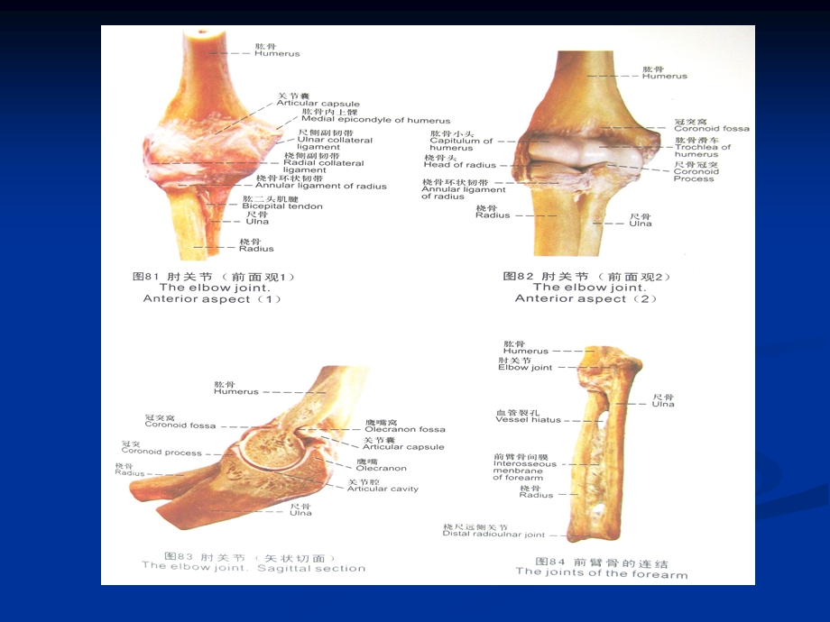 小儿肱骨髁上骨折优质ppt课件.ppt_第3页