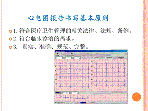 心电图报告的书写规范化及相关问题课件.ppt