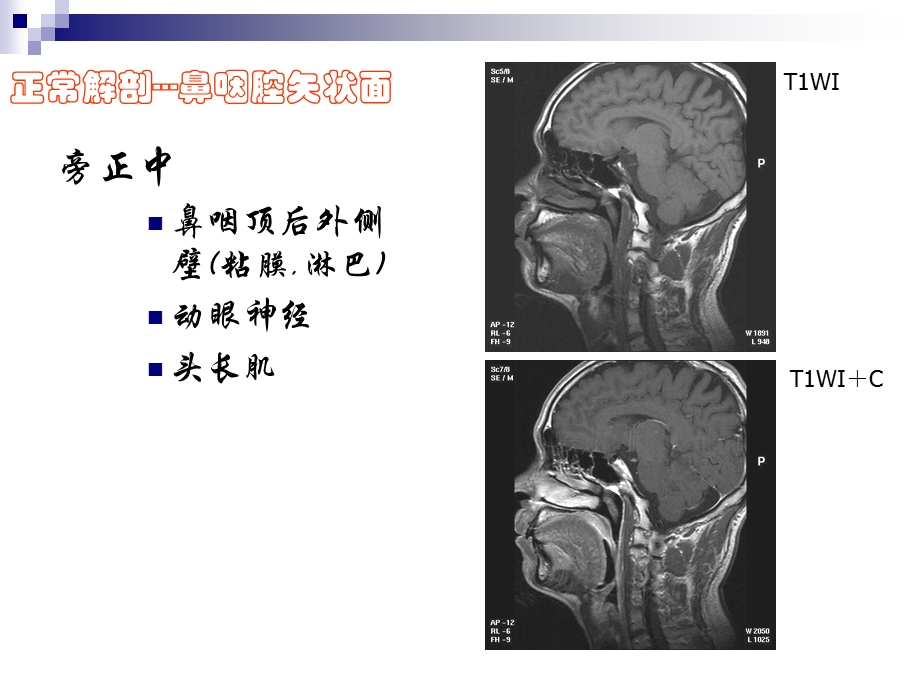 正常颈部解剖课件.ppt_第2页