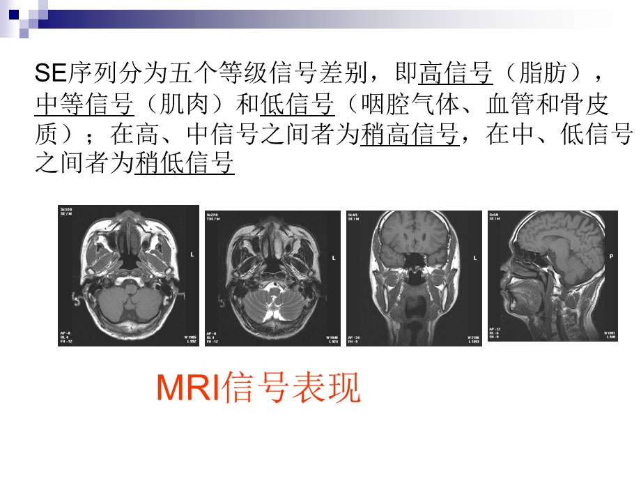 正常颈部解剖课件.ppt_第3页