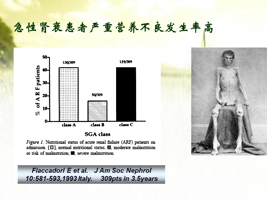 急性肾衰患者的营养支持课件.ppt_第3页