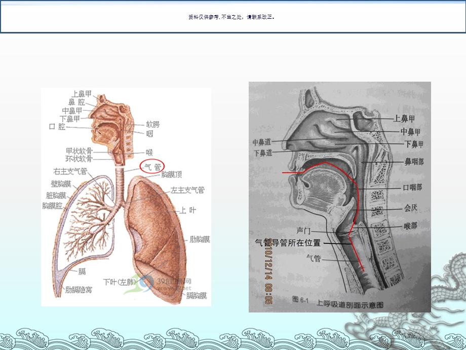 气管切开后患者的护理措施和注意事项课件.ppt_第2页