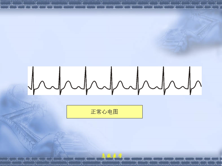 急诊心律失常课件.ppt_第2页