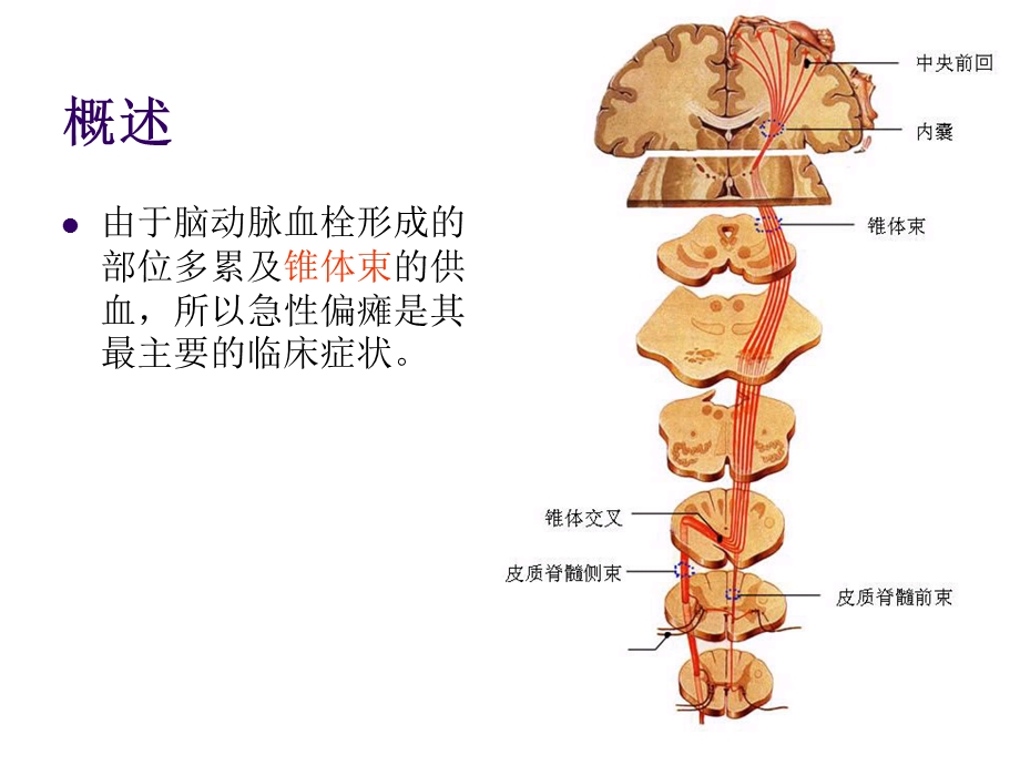 小儿急性偏瘫优质ppt课件.ppt_第3页