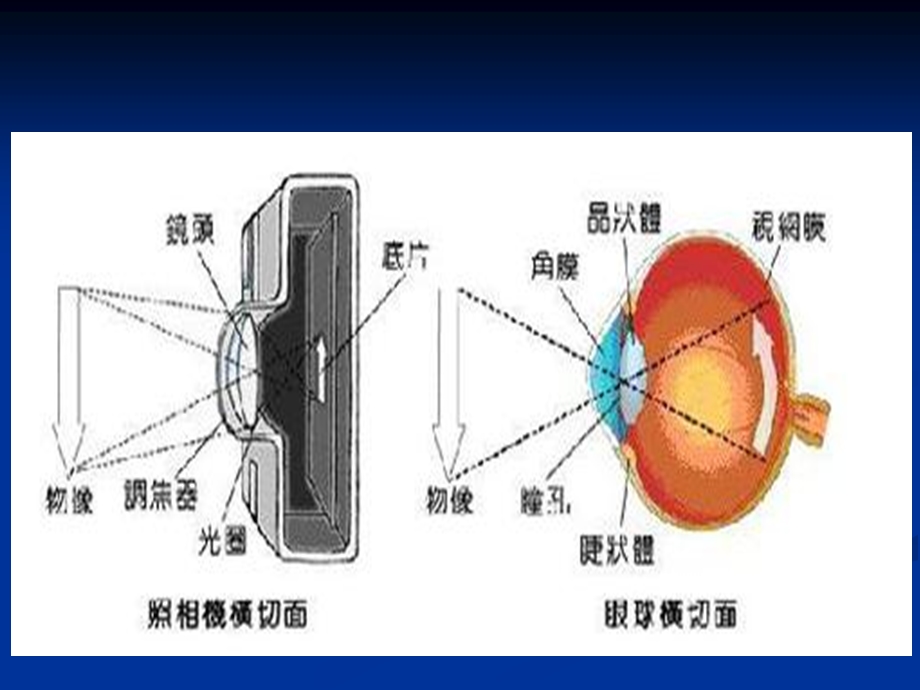 急性闭角型青光眼的诊疗和治疗培训ppt课件.ppt_第2页