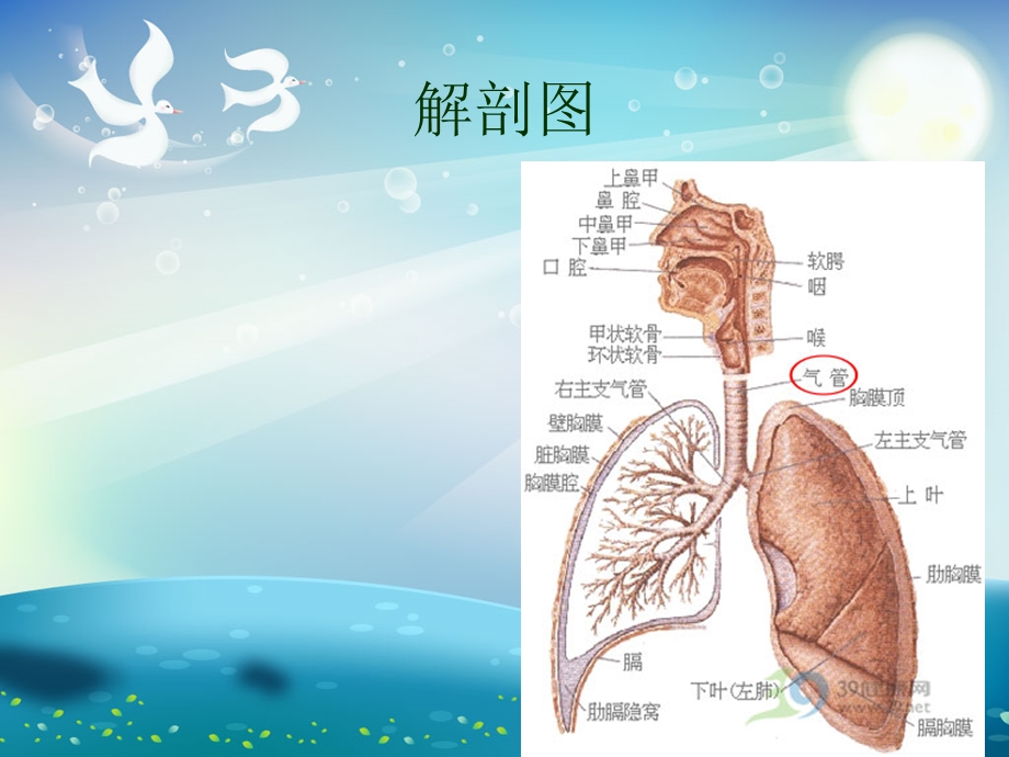 气管切开与气管插管术后护理ppt课件.ppt_第3页