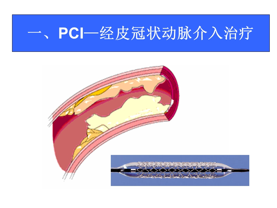 心脏康复指南学习课件.ppt_第1页