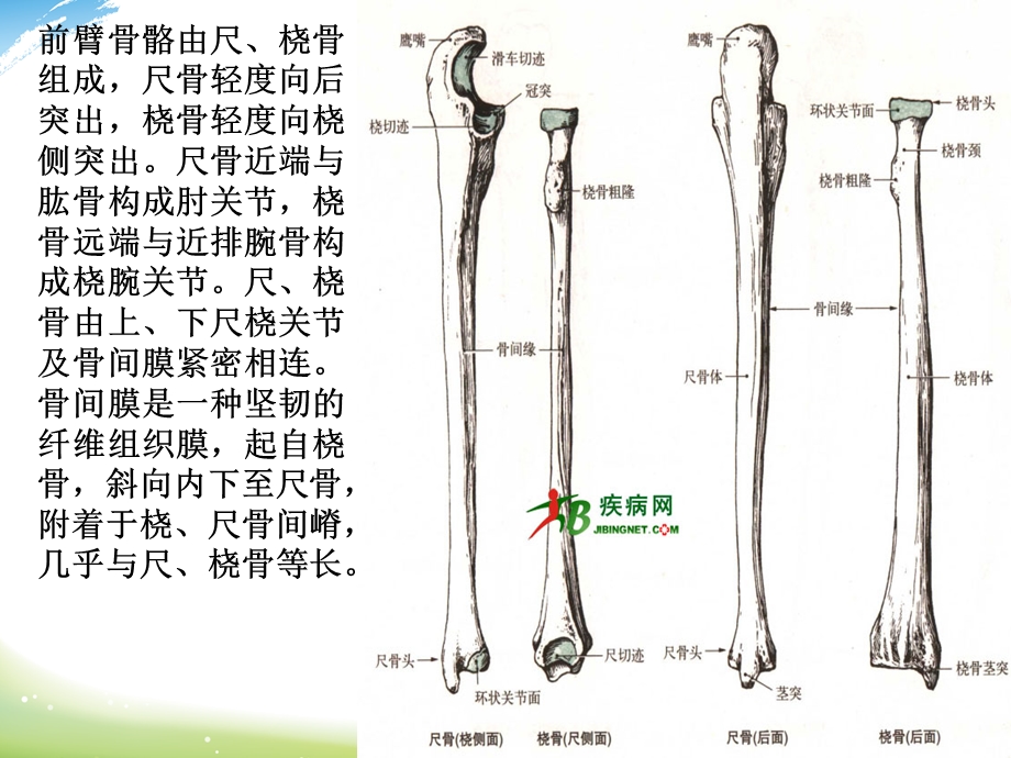 尺桡骨骨折的护理课件.ppt_第3页