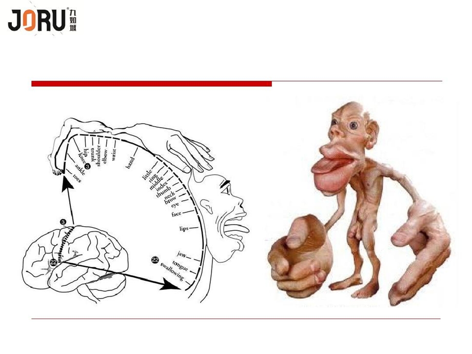 手功能障碍精准评估与治疗课件.ppt_第3页