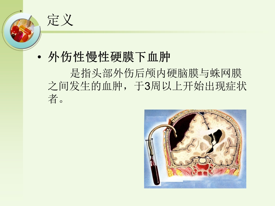 慢性硬膜下血肿 医学ppt课件.ppt_第3页