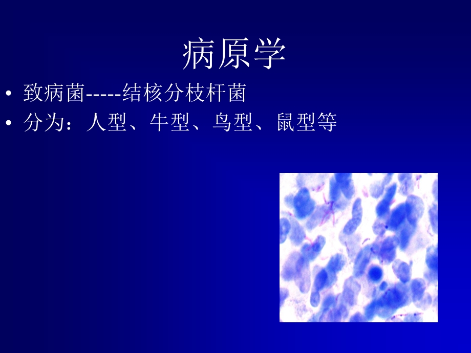 肺结核-ppt课件.ppt_第3页