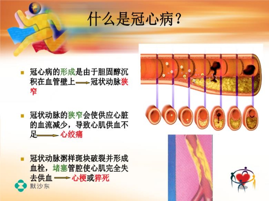 冬季心血管病的防治-PPT课件.ppt_第3页