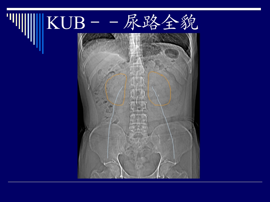 泌尿系统影像学诊断.ppt_第3页