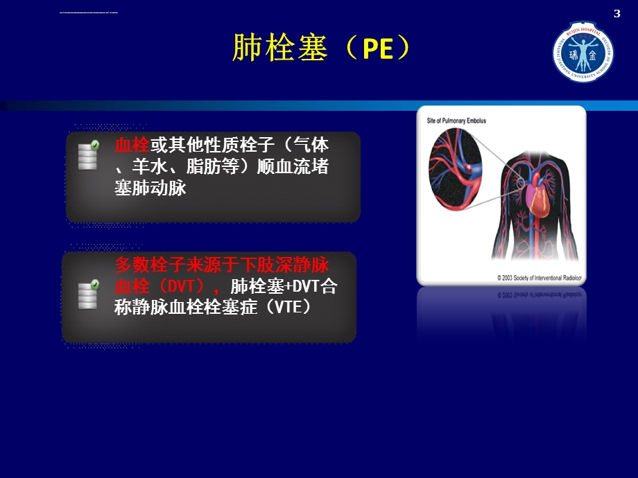 住院患者的VTE风险和防治ppt课件.ppt_第3页