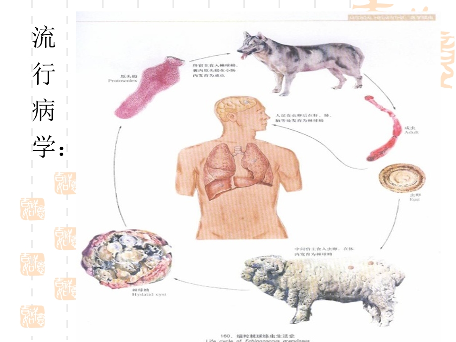 外科学肝包虫病的诊断及治疗.ppt_第3页