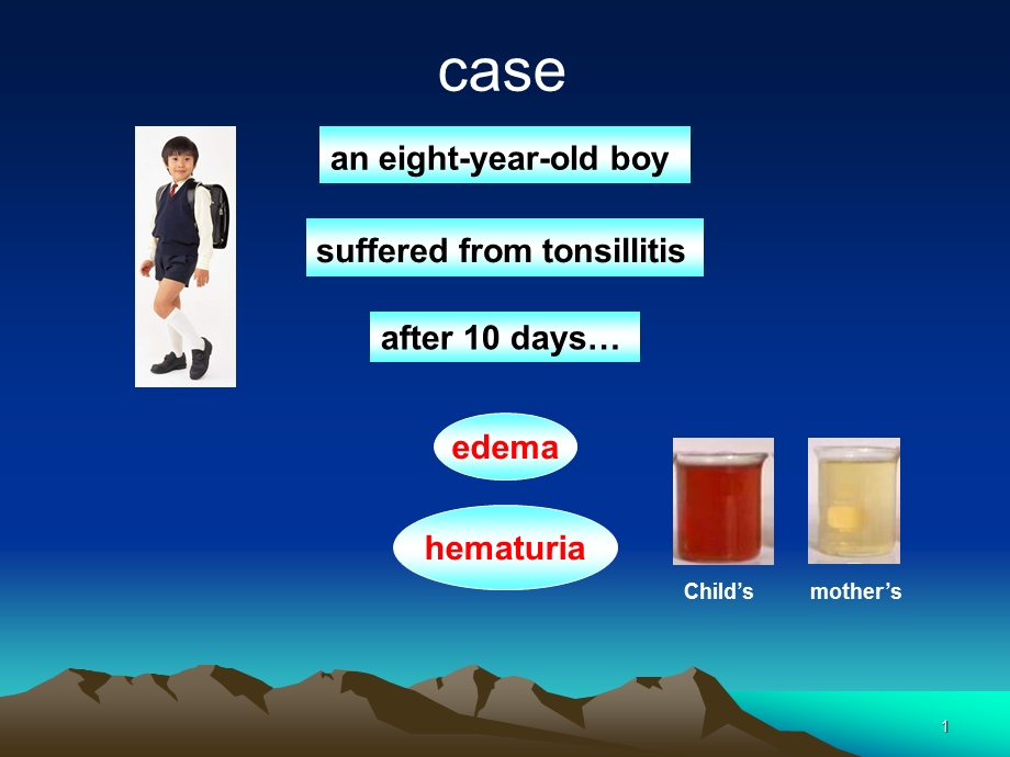 急性肾小球肾炎讲课.ppt_第1页