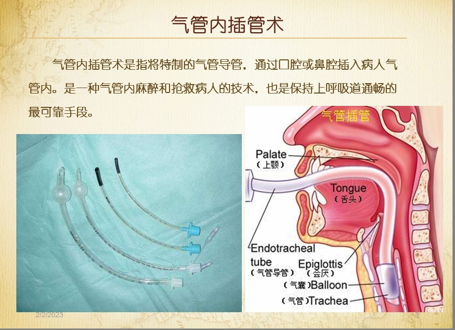 10.气管内插管术与气管切开术.ppt.ppt_第3页