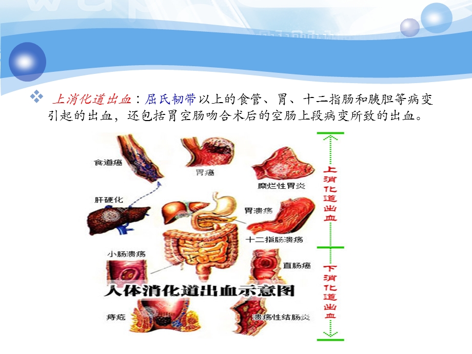 消化道出血病人的护理查房.ppt_第3页