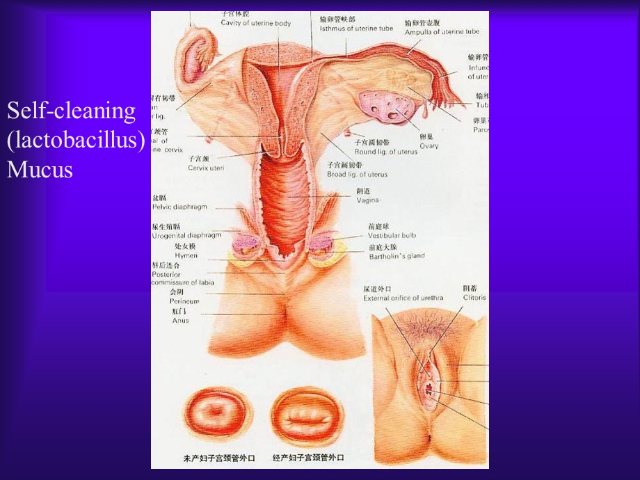 1104妇科炎症要点.ppt_第3页