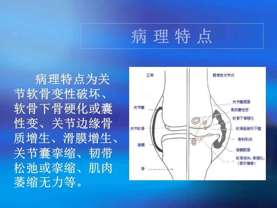 骨关节炎的康复治疗(茹).ppt_第3页