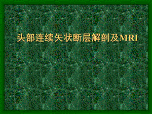 03头部连续矢状断层解剖及MRI.ppt