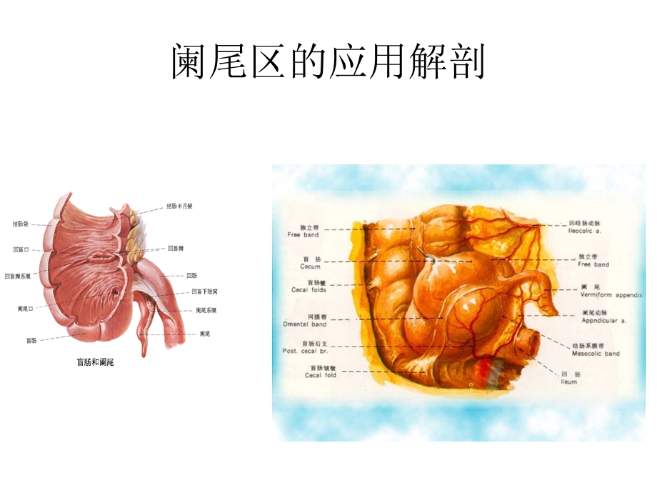 急性阑尾炎.ppt.ppt_第3页