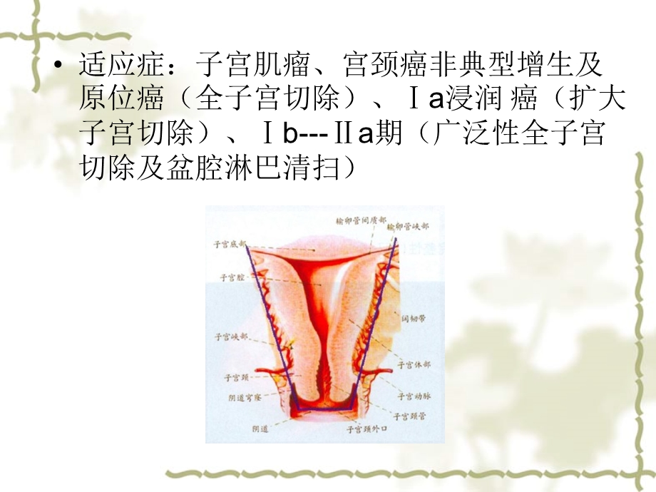 手术配合教学课件腹宫.ppt_第3页