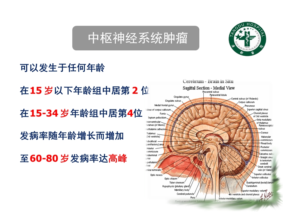 复发性高级别胶质瘤抗血管生成治疗演讲比赛.ppt_第2页