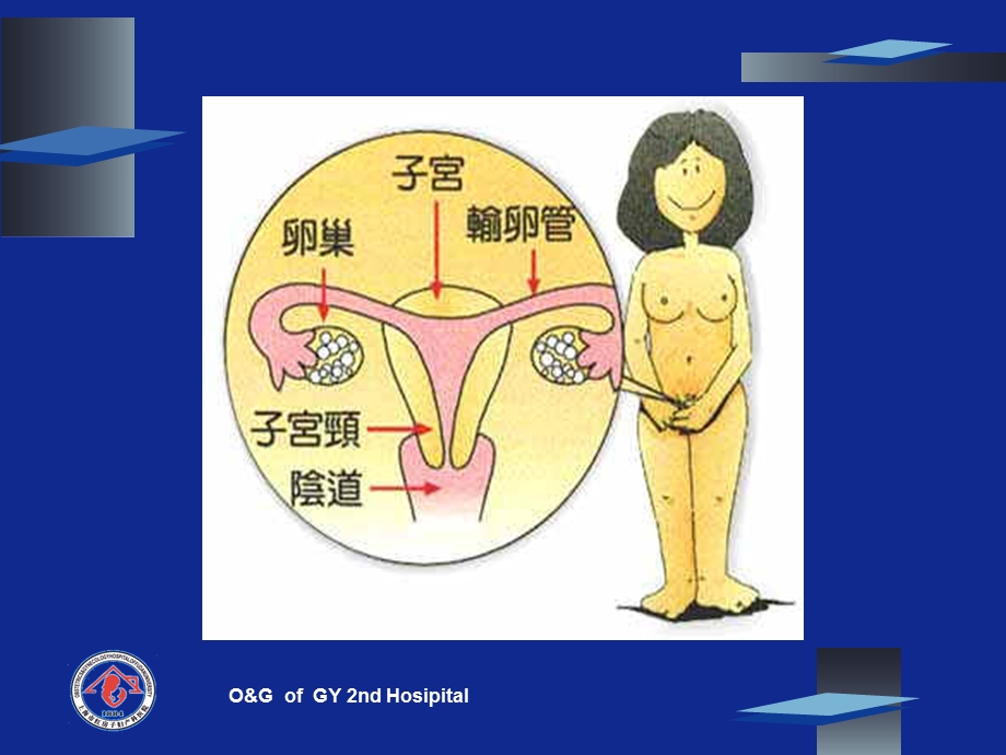 妇科肿瘤.ppt_第3页