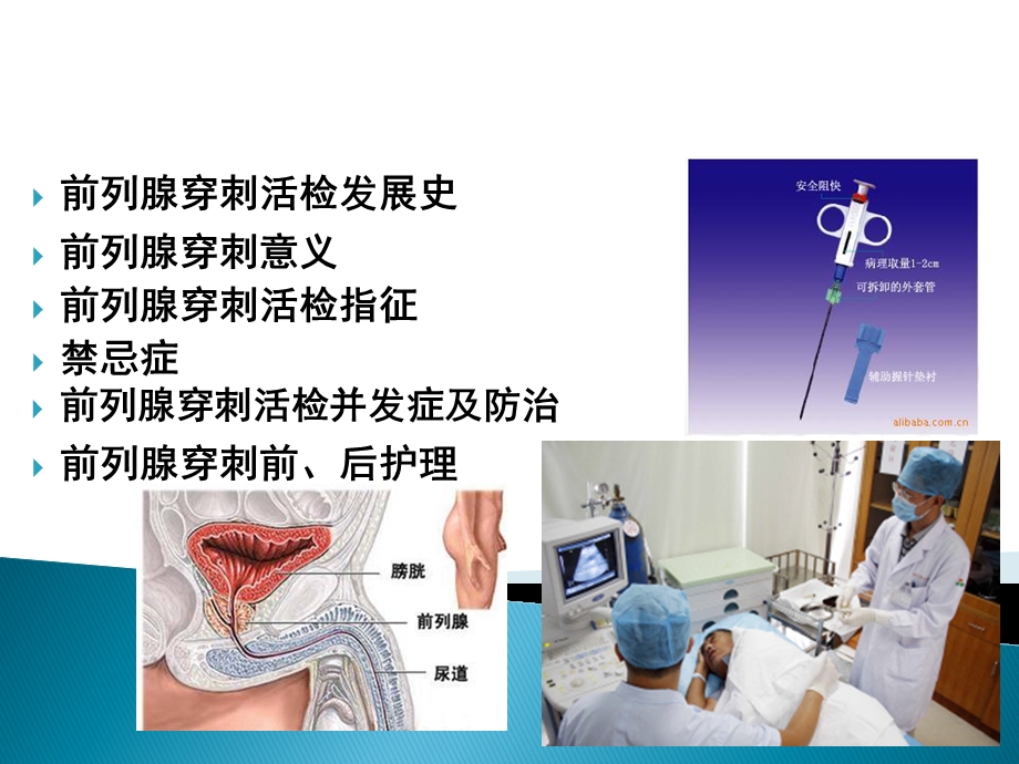 前列腺穿刺活检.ppt_第2页