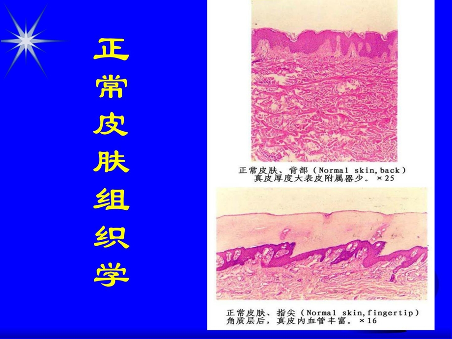 皮肤移植植皮术1461056852[指南].ppt_第3页