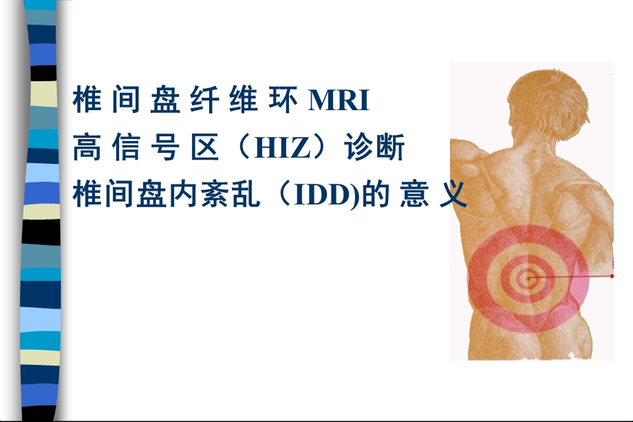 椎间盘纤维环MRI高信号区诊断椎间盘内紊乱(IDD)的意义.ppt_第1页