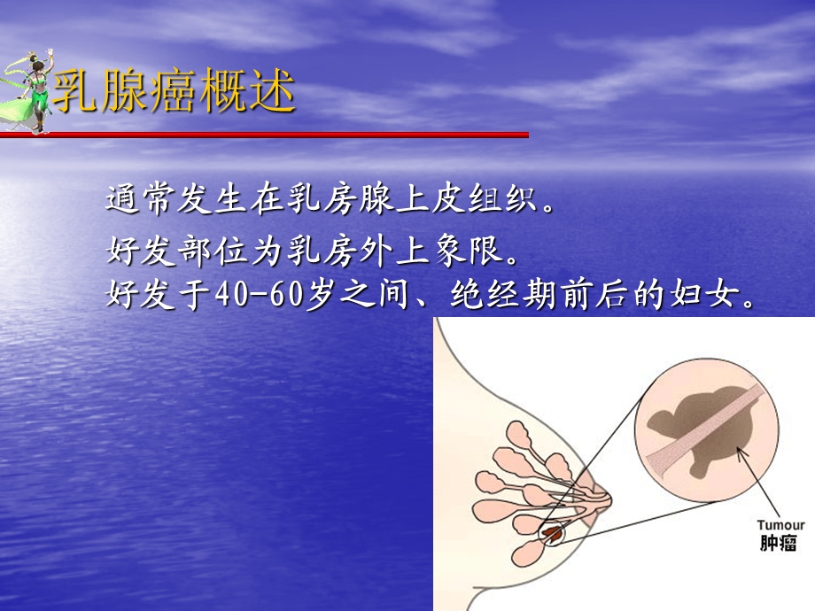 乳腺癌的综合治疗.ppt_第2页