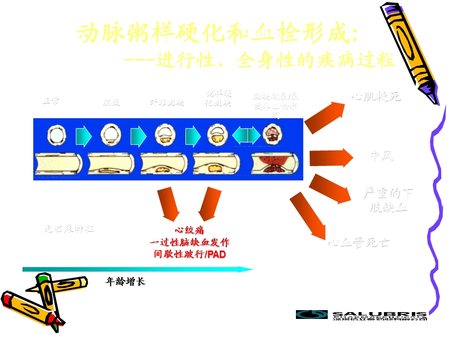 泰嘉在ACS & PCI术中的应用.ppt_第2页