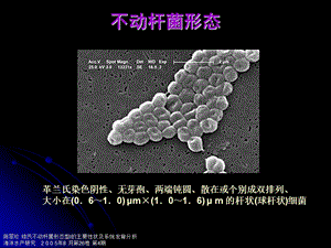 鲍曼不动杆菌感染(吴金)【精品PPT】 .ppt