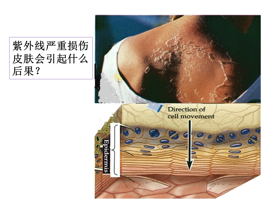 增殖凋亡异常与疾病10.ppt_第3页