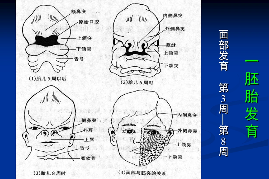 【临床医学】27 先天性唇、面裂和腭裂.ppt_第3页