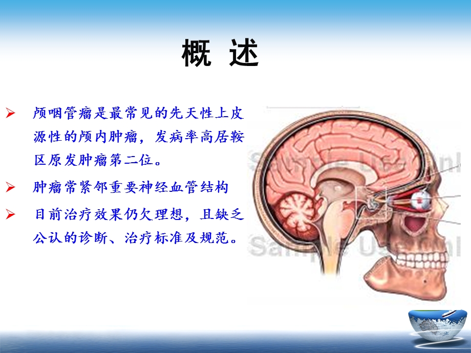 颅咽管瘤目前网上最好的ppt.ppt_第2页