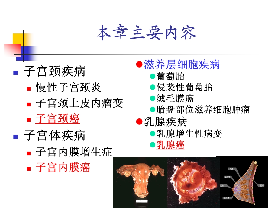 生殖系统、乳腺疾病.ppt_第2页