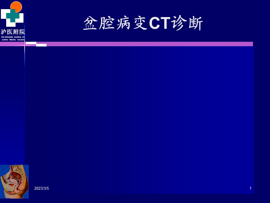 女性生殖系统疾病CT诊断.ppt_第1页