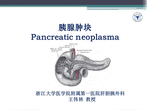 胰腺肿瘤.ppt.ppt