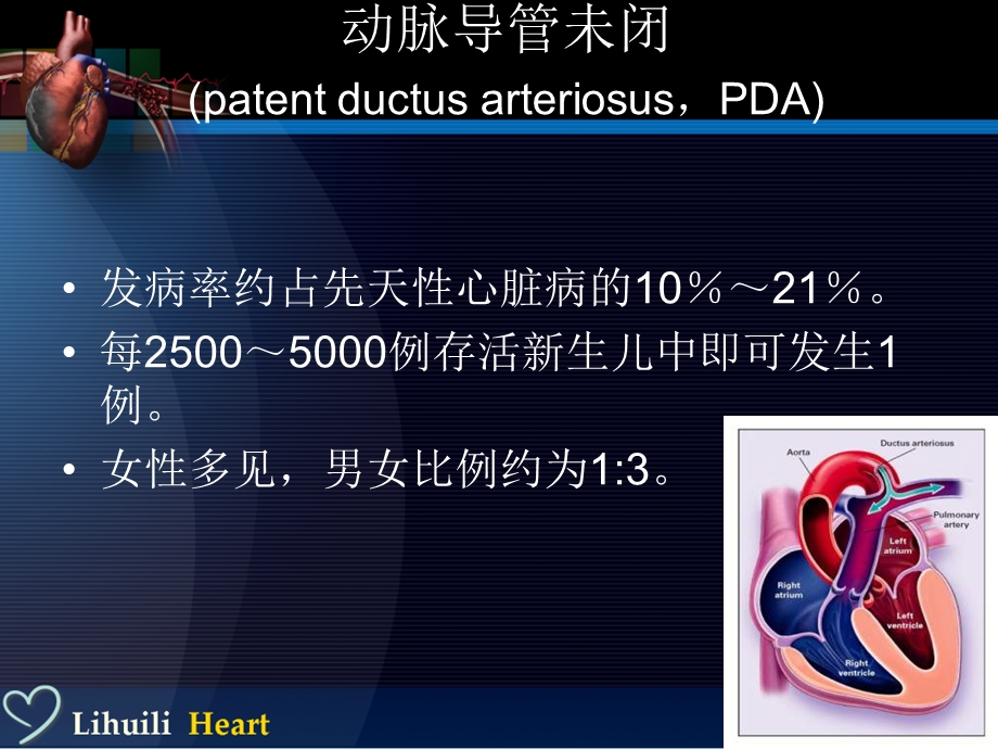 先天性心脏病介入治疗现状.ppt_第3页